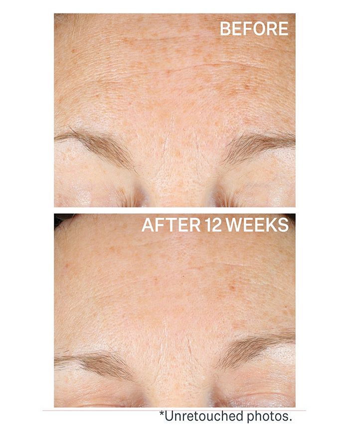 StriVectin Super C Retinol Brighten and Correct Vitamin C Serum, 1oz