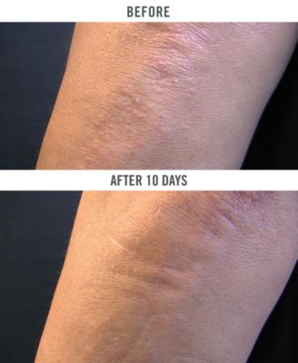 the bump eraser body scrub