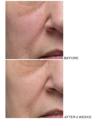 elemis peptide4 day cream