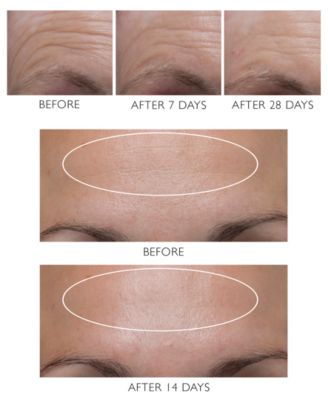 hungarian thermal water moisturizer